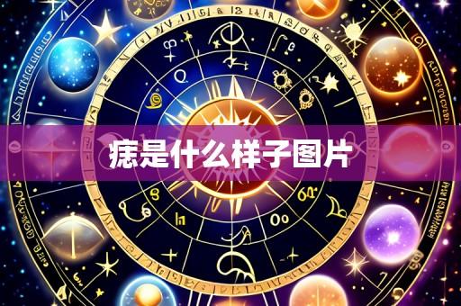 痣是什么样子图片